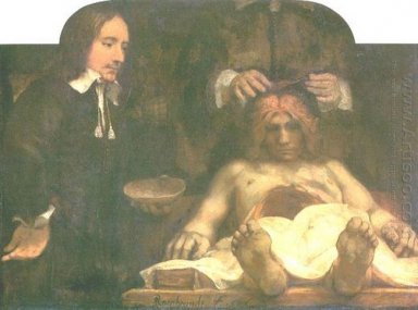 Anatomia de Doctor Deyman 1656