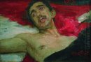 Wounded Man 1913